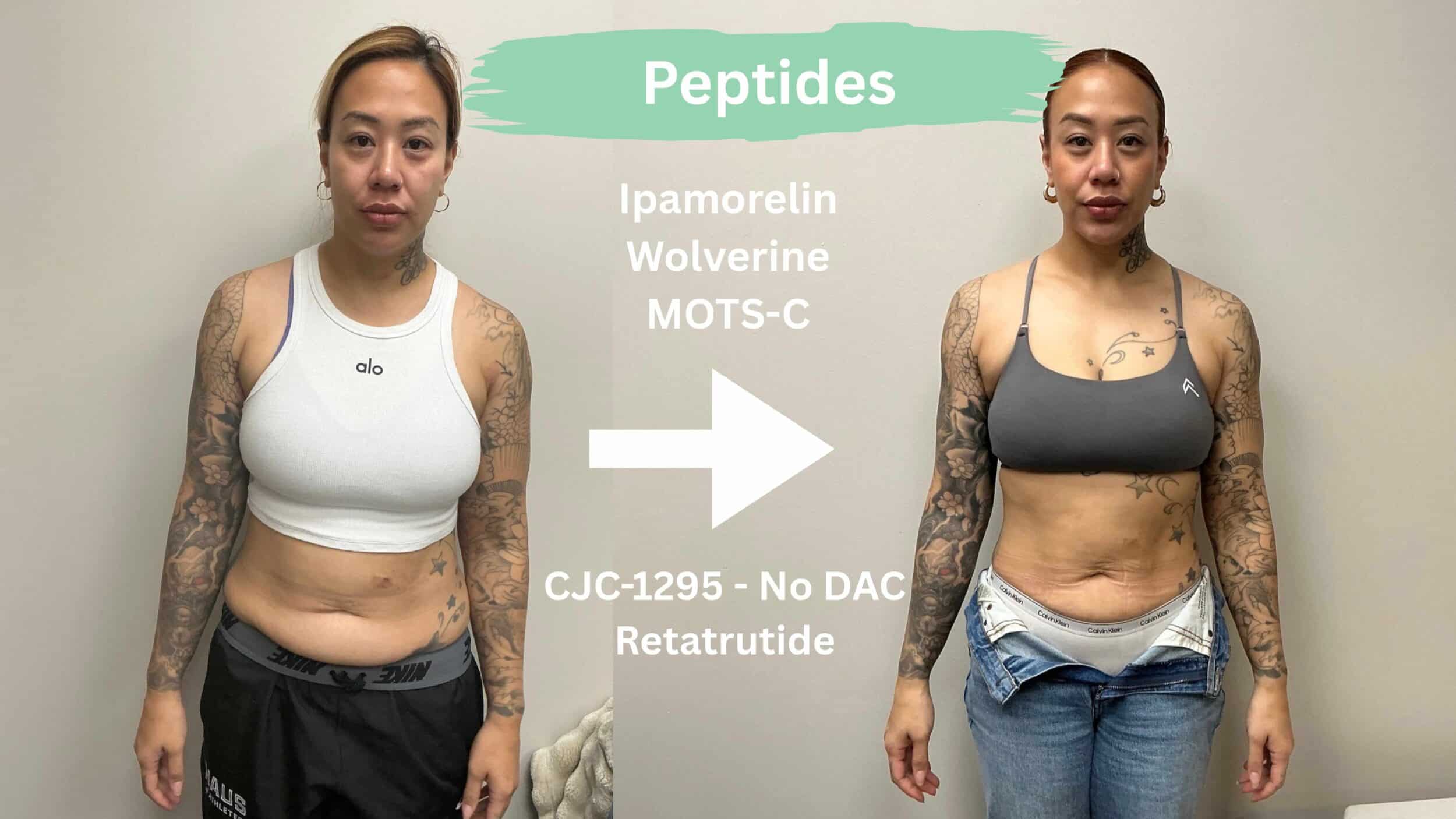 Before and After Image: Peptides - front