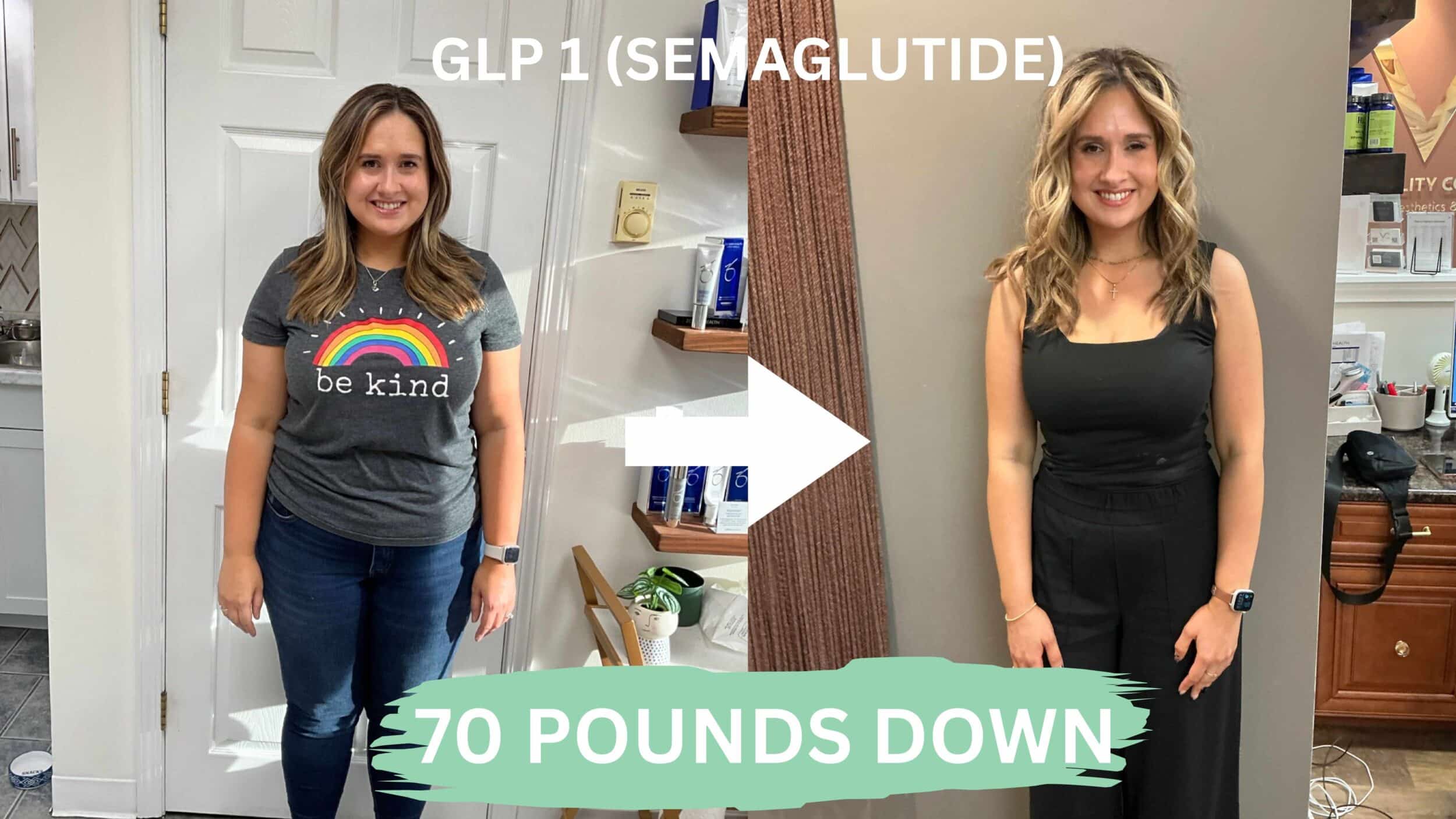 Before and After Image: Weight Loss - front