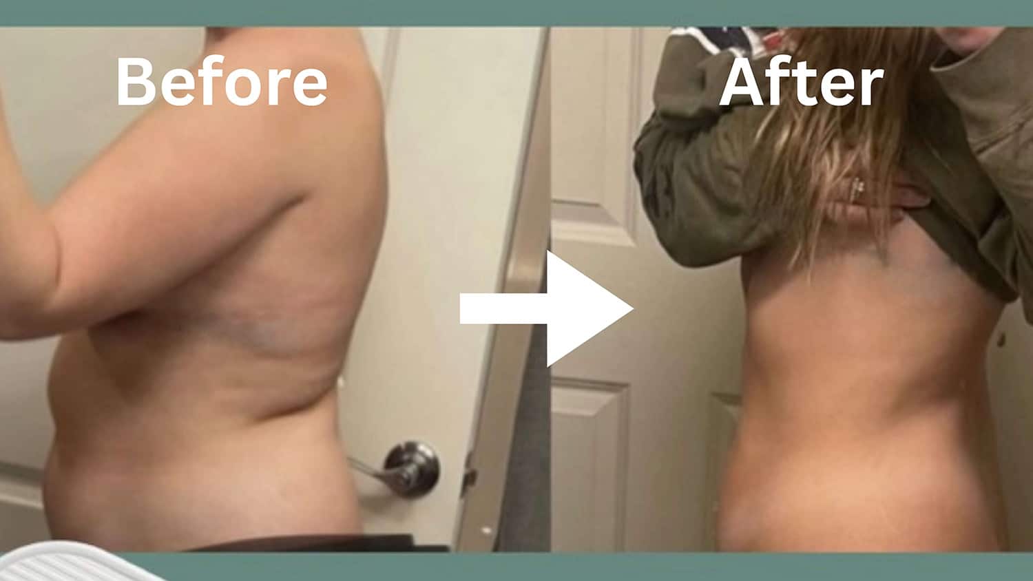 Before and After Image: Weight Loss - left-side