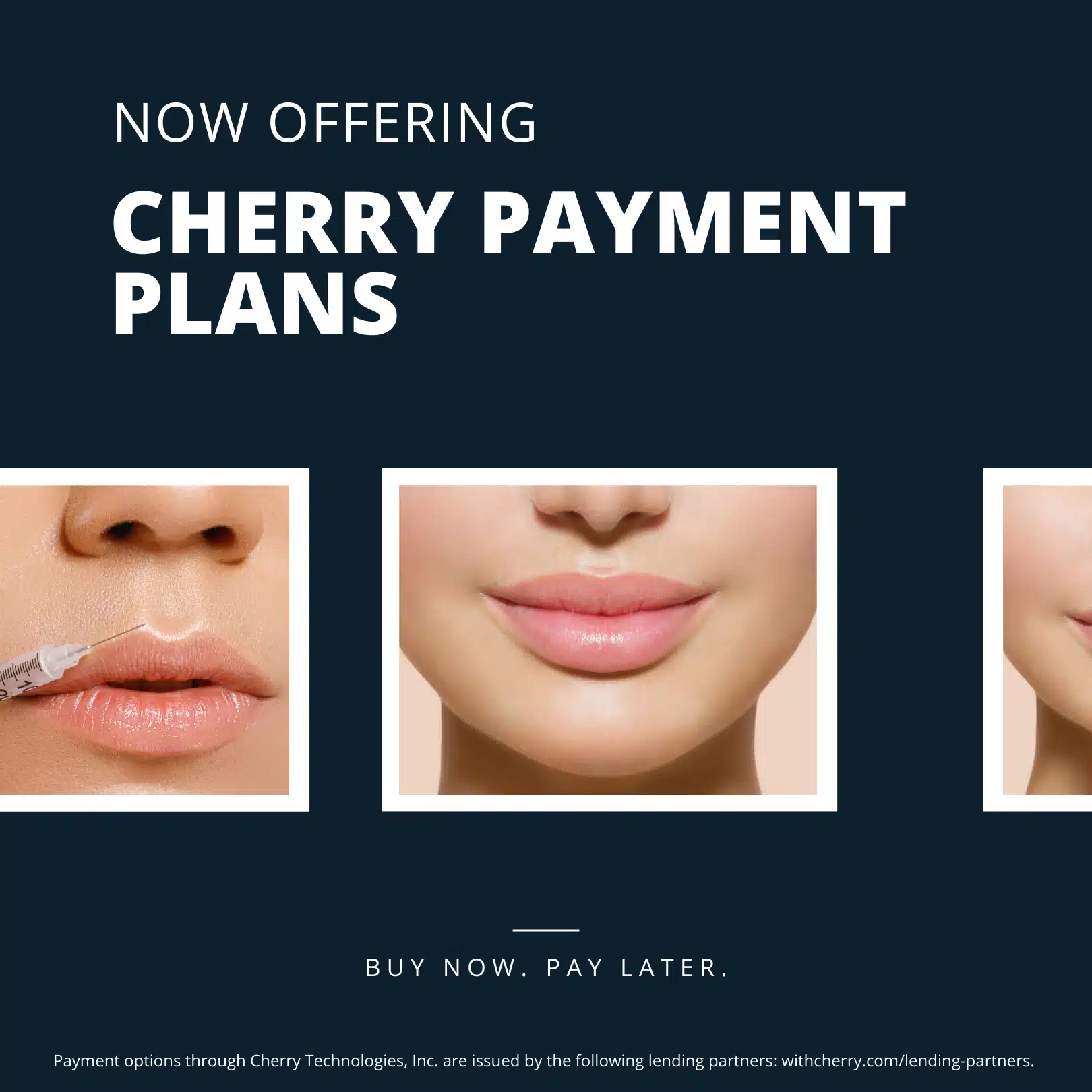 Cherry Payment Plans promotion with lip enhancement images.