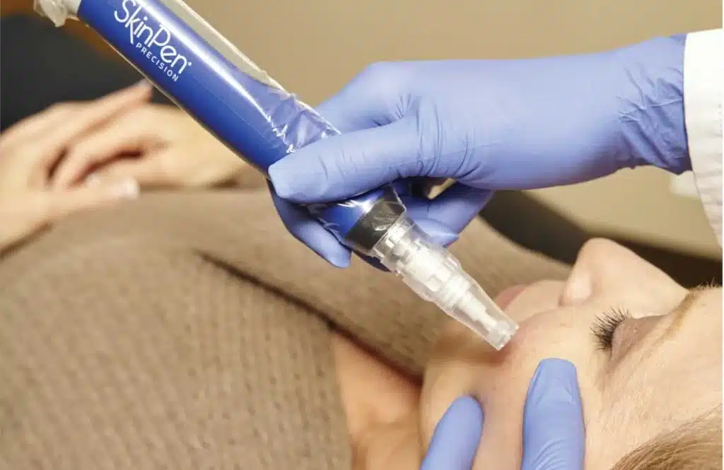 Maureen McSwiggin performing SkinPen Microneedling treatment.
